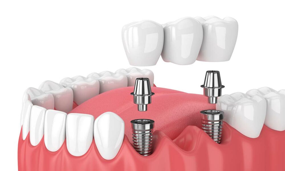 dental 5