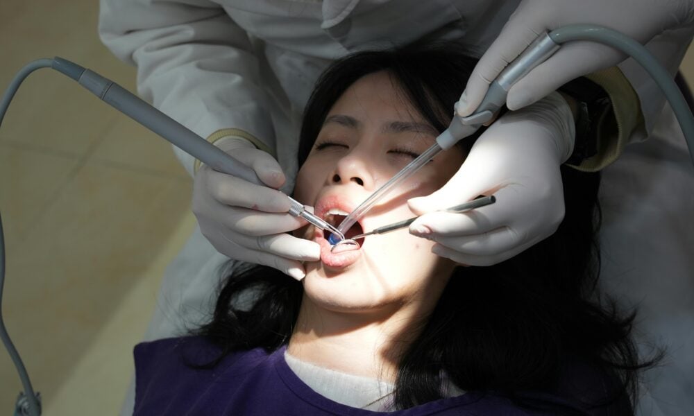 Root Canal in Singapore