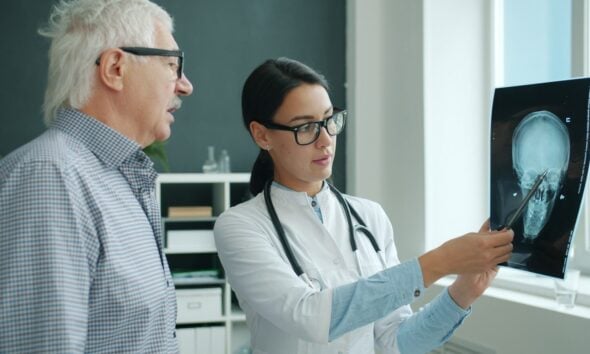 Doctor shows x-ray scan to an elderly patient.