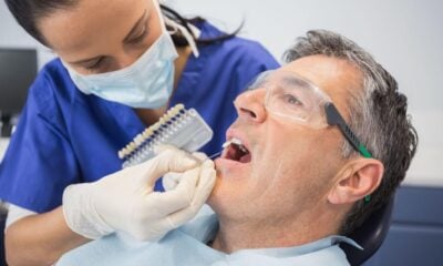 Dental Crowns