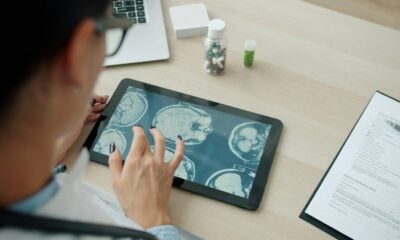 Doctor examining mri scans on a tablet screen