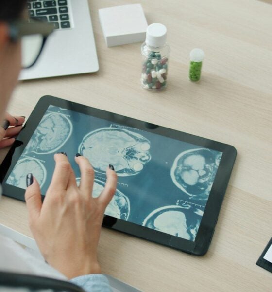 Doctor examining mri scans on a tablet screen