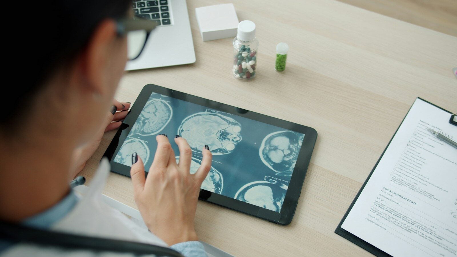 Doctor examining mri scans on a tablet screen